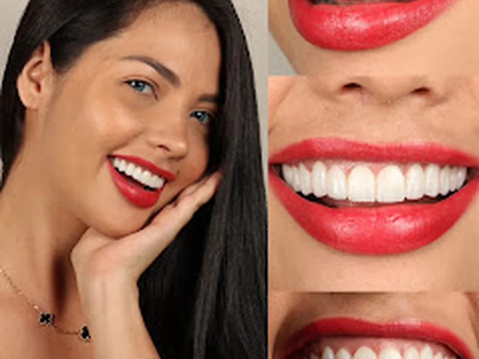 Ame Dental Studio - Carillas Dentales | Blanqueamiento Dental | Implantes Dentales | Ortodoncia