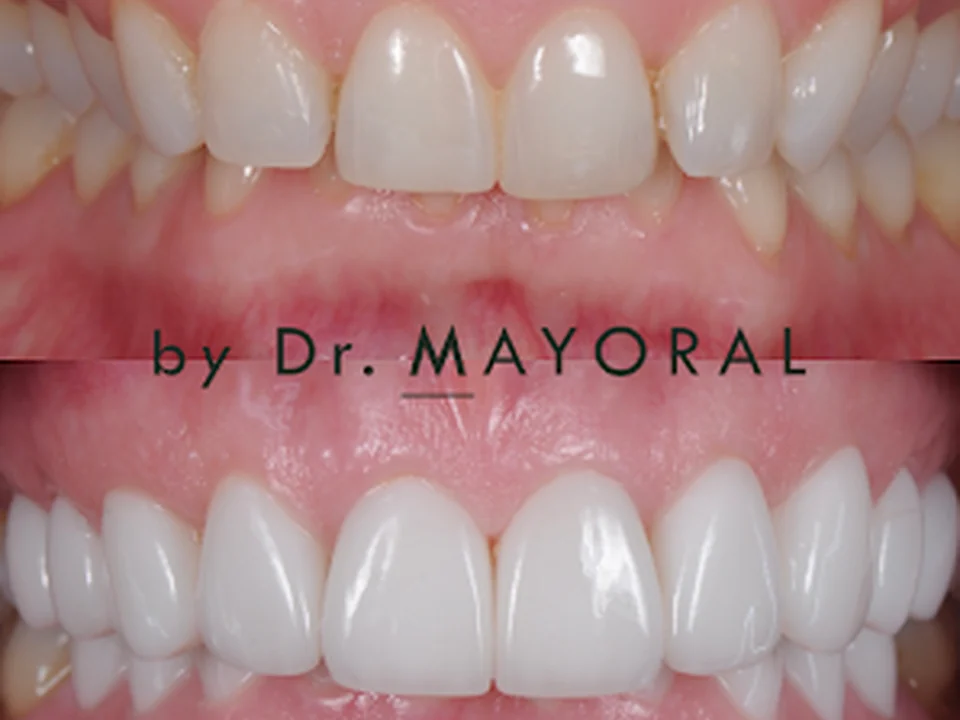 Barcelona Smile Center - Estética Dental