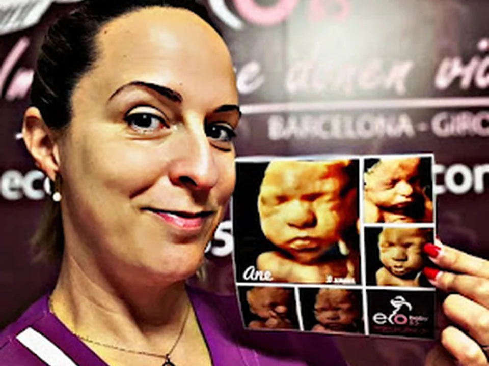 Foto de Ecografía 5D Barcelona, Eco Baby Centro de Ecografías 5D