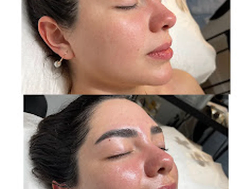 Limpieza facial en barcelona